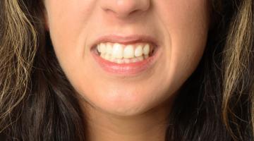 Frau zeigt Zähne