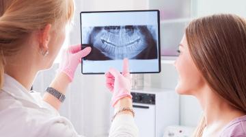 Zahnärztin erklärt Röntgenbild