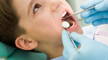 Untersuchung der Zähne mit einem Mundspiegel