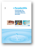 3. Parodontitis - Erkrankungen des Zahnhalteapparates vermeiden, erkennen, behandeln